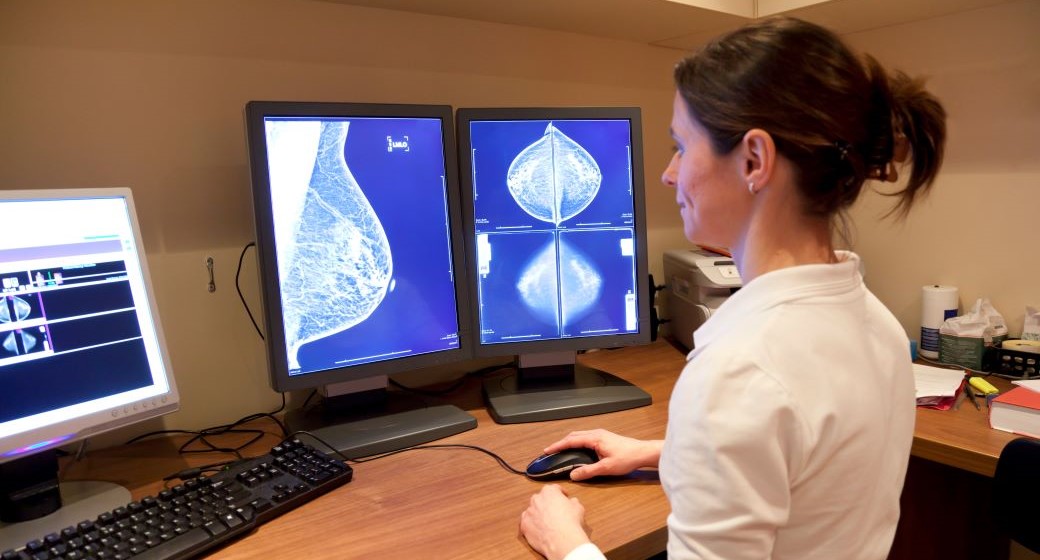 Radiology technician looking at mammography
